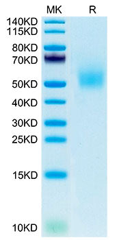 Recombinant Mouse DLK1 Protein