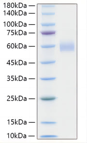 Recombinant Human Lp-PLA2/PLA2G7 Protein
