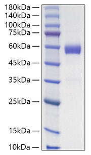 Recombinant Human Placenta growth factor/PlGF-131/PlGF-1 Protein