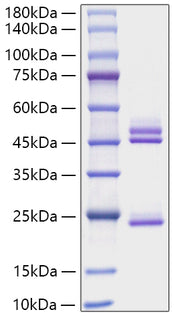 Recombinant Mouse IL-23/IL-12B&IL-23A Protein