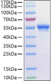 Recombinant Human Glucose-6-phosphate 1-dehydrogenase/G6PD Protein
