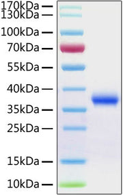 Recombinant Human Aldehyde reductase/AKR1B1 Protein