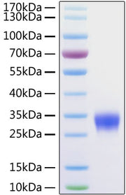 Recombinant Mouse VSIG4 Protein