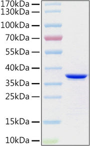 Recombinant Human Collagen II alpha 1/COL2A1 Protein