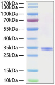Recombinant Human IFI30 Protein