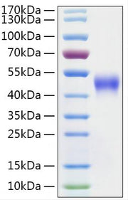 Recombinant Mouse IL-2 R beta/CD122 Protein
