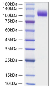 Recombinant Human NCAM-1/CD56 Protein
