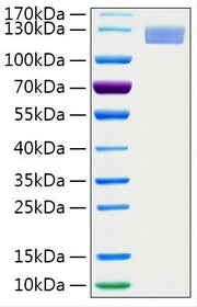 Recombinant Human ERAP2 Protein
