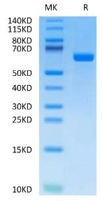Recombinant Human Alkaline Phosphatase (Germ type) /ALPG Protein