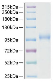Recombinant SARS-CoV-2 RNA-dependent RNA polymerase/RDRP Protein