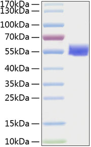 Recombinant Human Vimentin/VIM Protein