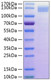 Recombinant Human Gelsolin/GSN Protein