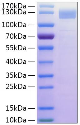 Recombinant Human Gelsolin/GSN Protein