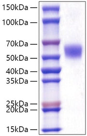 Recombinant Human LAP3 Protein