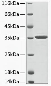 Recombinant Human Aminoacylase-3/ACY 3 Protein