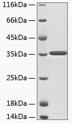Recombinant Human Aminoacylase-3/ACY 3 Protein