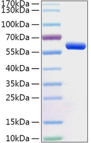 Recombinant Human Protein disulfide-isomerase/PDI Protein