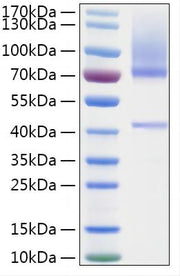 Recombinant Human HGF Activator/HGFA Protein