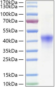 Recombinant Human NDRG1 Protein