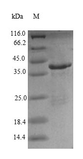 (Tris-Glycine gel) Discontinuous SDS-PAGE (reduced) with 5% enrichment gel and 15% separation gel.