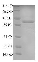(Tris-Glycine gel) Discontinuous SDS-PAGE (reduced) with 5% enrichment gel and 15% separation gel.