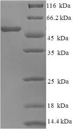 (Tris-Glycine gel) Discontinuous SDS-PAGE (reduced) with 5% enrichment gel and 15% separation gel.