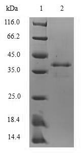 (Tris-Glycine gel) Discontinuous SDS-PAGE (reduced) with 5% enrichment gel and 15% separation gel.