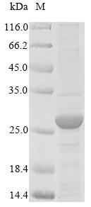 (Tris-Glycine gel) Discontinuous SDS-PAGE (reduced) with 5% enrichment gel and 15% separation gel.