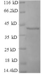 (Tris-Glycine gel) Discontinuous SDS-PAGE (reduced) with 5% enrichment gel and 15% separation gel.