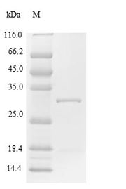 (Tris-Glycine gel) Discontinuous SDS-PAGE (reduced) with 5% enrichment gel and 15% separation gel.