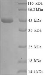 (Tris-Glycine gel) Discontinuous SDS-PAGE (reduced) with 5% enrichment gel and 15% separation gel.