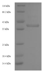 (Tris-Glycine gel) Discontinuous SDS-PAGE (reduced) with 5% enrichment gel and 15% separation gel.