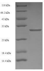 (Tris-Glycine gel) Discontinuous SDS-PAGE (reduced) with 5% enrichment gel and 15% separation gel.