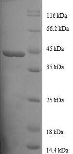 (Tris-Glycine gel) Discontinuous SDS-PAGE (reduced) with 5% enrichment gel and 15% separation gel.