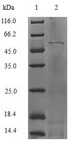 (Tris-Glycine gel) Discontinuous SDS-PAGE (reduced) with 5% enrichment gel and 15% separation gel.