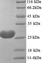 (Tris-Glycine gel) Discontinuous SDS-PAGE (reduced) with 5% enrichment gel and 15% separation gel.
