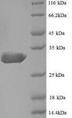 (Tris-Glycine gel) Discontinuous SDS-PAGE (reduced) with 5% enrichment gel and 15% separation gel.