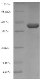 (Tris-Glycine gel) Discontinuous SDS-PAGE (reduced) with 5% enrichment gel and 15% separation gel.