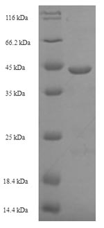 (Tris-Glycine gel) Discontinuous SDS-PAGE (reduced) with 5% enrichment gel and 15% separation gel.