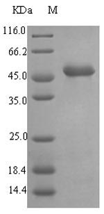 (Tris-Glycine gel) Discontinuous SDS-PAGE (reduced) with 5% enrichment gel and 15% separation gel.