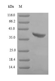(Tris-Glycine gel) Discontinuous SDS-PAGE (reduced) with 5% enrichment gel and 15% separation gel.