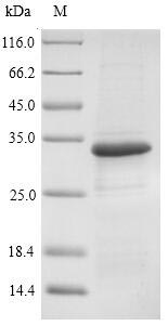 (Tris-Glycine gel) Discontinuous SDS-PAGE (reduced) with 5% enrichment gel and 15% separation gel.