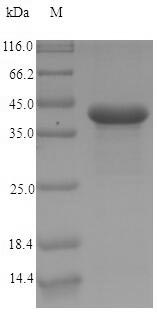 (Tris-Glycine gel) Discontinuous SDS-PAGE (reduced) with 5% enrichment gel and 15% separation gel.
