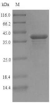 (Tris-Glycine gel) Discontinuous SDS-PAGE (reduced) with 5% enrichment gel and 15% separation gel.
