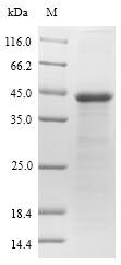 (Tris-Glycine gel) Discontinuous SDS-PAGE (reduced) with 5% enrichment gel and 15% separation gel.