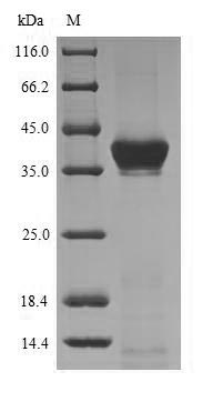 (Tris-Glycine gel) Discontinuous SDS-PAGE (reduced) with 5% enrichment gel and 15% separation gel.