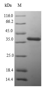 (Tris-Glycine gel) Discontinuous SDS-PAGE (reduced) with 5% enrichment gel and 15% separation gel.