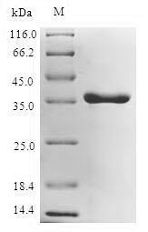 (Tris-Glycine gel) Discontinuous SDS-PAGE (reduced) with 5% enrichment gel and 15% separation gel.