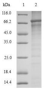 (Tris-Glycine gel) Discontinuous SDS-PAGE (reduced) with 5% enrichment gel and 15% separation gel.