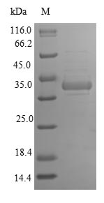 (Tris-Glycine gel) Discontinuous SDS-PAGE (reduced) with 5% enrichment gel and 15% separation gel.